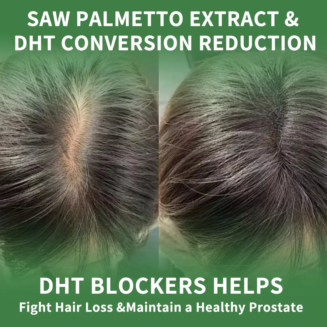 Saw Palmetto Supplement – Prostate &amp; Hair Support