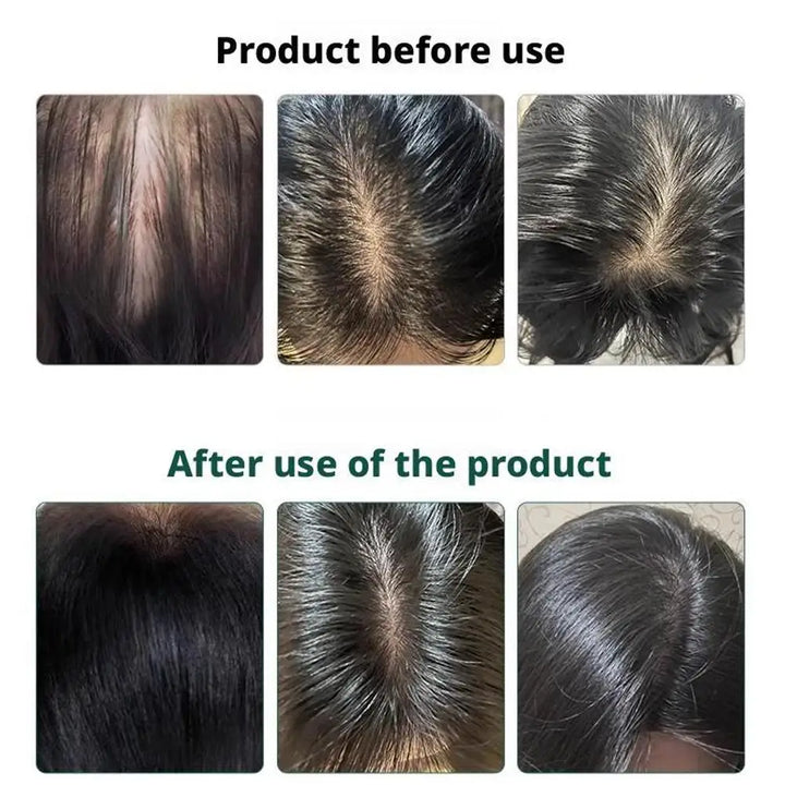 Zhang Guang 101 formula (101P) 120ml Chinese medicine therapy anti hair loss hair care nourish the hair follicle hair regrowth