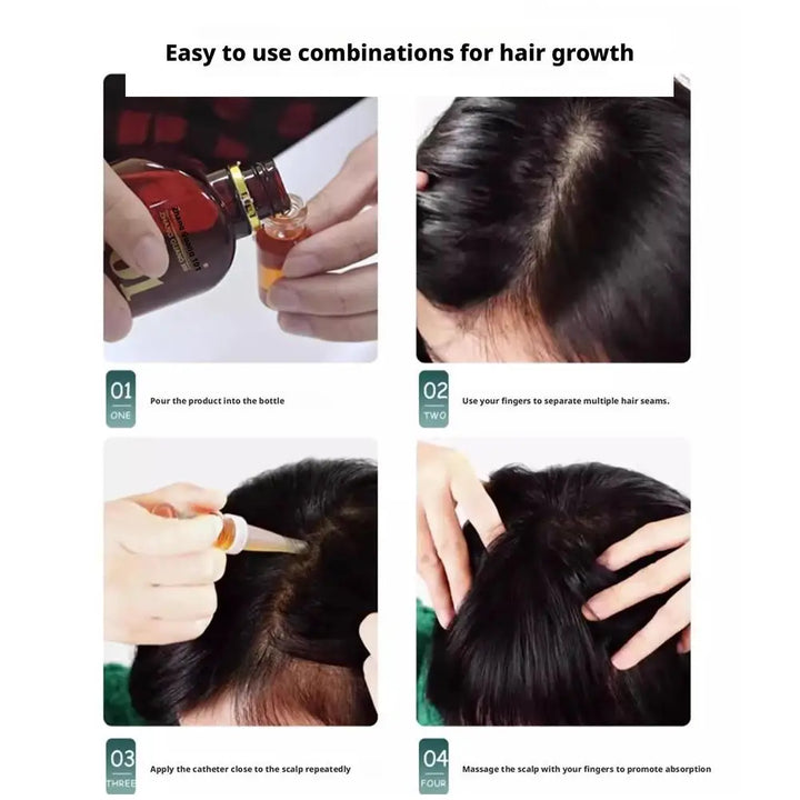 Zhang Guang 101 formula (101P) 120ml Chinese medicine therapy anti hair loss hair care nourish the hair follicle hair regrowth