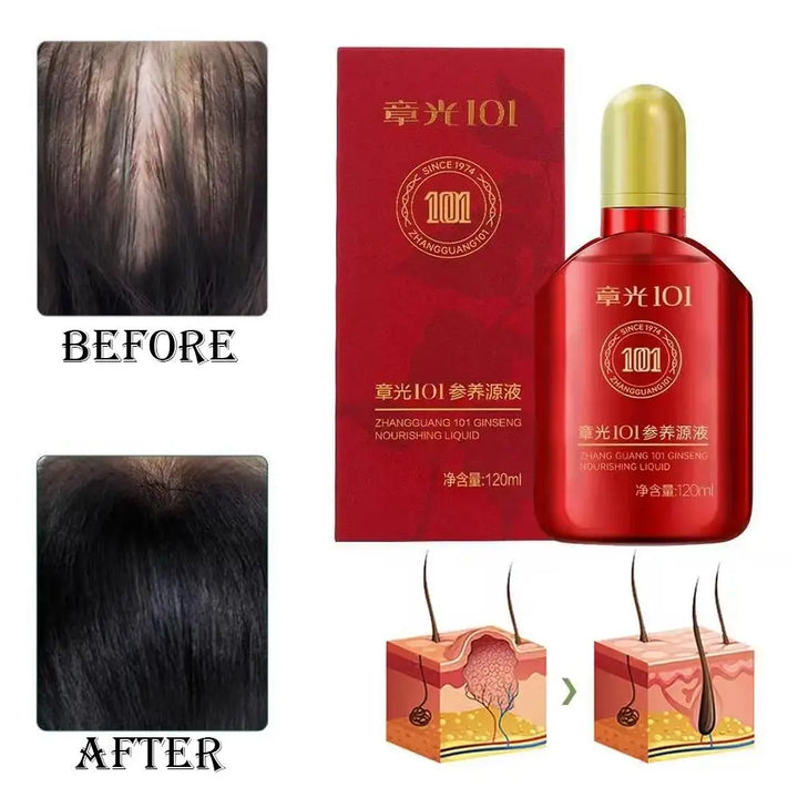 Zhang Guang 101 formula (101P) 120ml Chinese medicine therapy anti hair loss hair care nourish the hair follicle hair regrowth