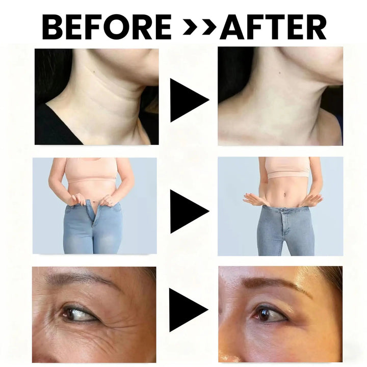 Lymph System Cleanse Detox Support  Lymphatic Drainage Supplement Accelerate Metabolism Reduce Swelling,Promote Fluid Balance