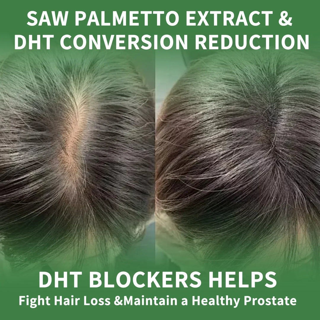 Saw Palmetto Supplement – Prostate &amp; Hair Support
